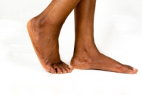 When Are Flat Feet a Problem?