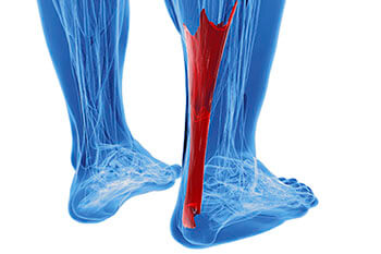 achilles tendon treatment in the Jupiter, FL 33458 area