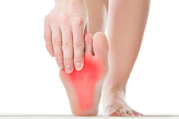 plantar fasciitis