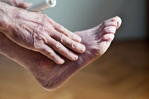Poor Circulation in Your Feet