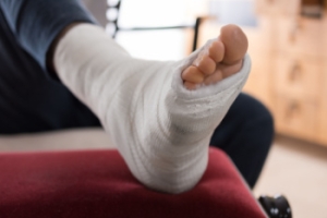 Recognizing the Symptoms of a Broken Ankle