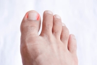 What Is the Proper Way of Cutting Toenails?
