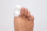 Managing a Broken Toe That Will Not Heal