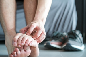 Signs of Athlete’s Foot