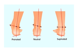 Causes and Complications of Supination