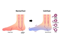 Causes of Chronic Cold Feet