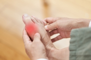 Understanding Gout and How to Manage It