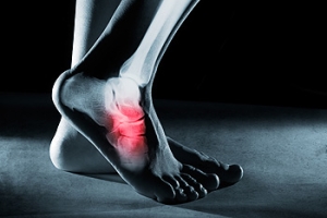 Where Is the Tarsal Tunnel?